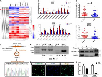 CircRNF111 Protects Against Insulin Resistance and Lipid Deposition via Regulating miR-143-3p/IGF2R Axis in Metabolic Syndrome
